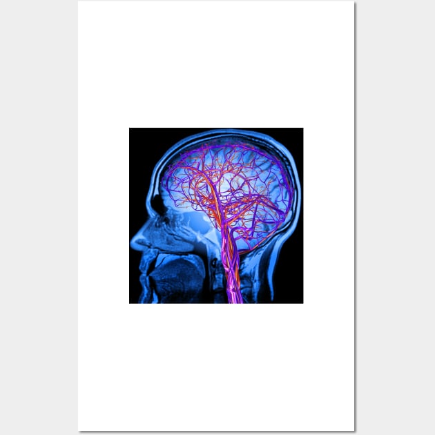 Vascular system of the brain, artwork (C024/6525) Wall Art by SciencePhoto